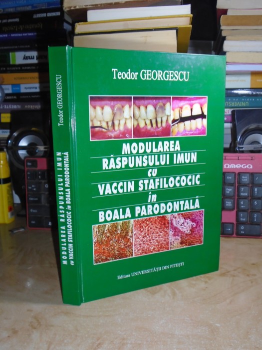 TEODOR GEORGESCU - MODULAREA RASPUNSULUI IMUN IN BOALA PARODONTALA , 2004 #