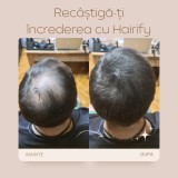 Fibre de păr din keratină pentru păr rar sau chelie - Hairify
