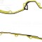 VICTOR REINZ 71-36261-00 Garnitura, distributie