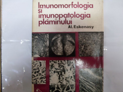 Imunomorfologia Si Imunopatologia Plaminului - Al. Eskenasy ,550559 foto
