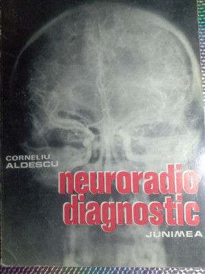 Neurodiagnostic,c Aldescu,folosit,25 lei foto