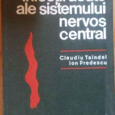 Infectii Acute Ale Sistemului Nervos Central - Claudiu Taindel Ion Predescu ,518831