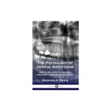 The Pathology of Dental Infections and Its Relation to General Diseases - History of Dentistry