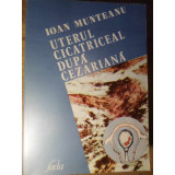 UTERUL CICATRICEAL DUPA CEZARIANA-IOAN MUNTEANU-232879