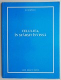 Celulita, in sfarsit invinsa &ndash; Robinson