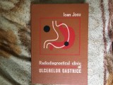 g1 Radiodiagnosticul Clinic Al Ulcerelor Gastrice - Ioan Jocu