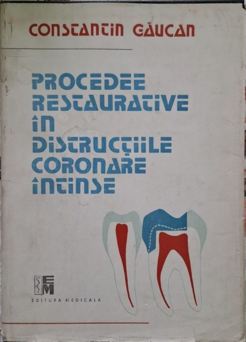 Procedee restaurative in distructiile coronare intinse