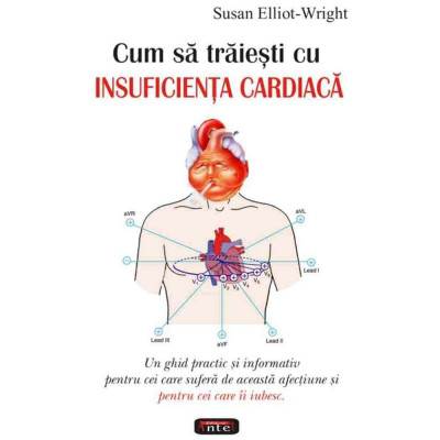 Cum sa traiesti cu insuficienta cardiaca - Susan Elliot-Wright foto