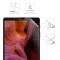 Foto  - 3