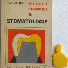 Metaloceramica in stomatologie Ivan Viforel