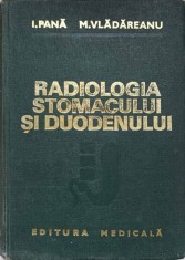 RADIOLOGIA STOMACULUI SI DUODENULUI-I. PANA, M. VLADAREANU-95954