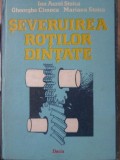 Severuirea Rotilor Dintate - I.A. Stoica, Gh. Cimoca, M. Stoica - Dacia 1986 - Carte Tehnica Inginerie Mecanica
