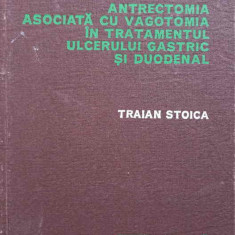 ANTRECTOMIA ASOCIATA CU VAGOTOMIA IN TRATAMENTUL ULCERULUI GASTRIC SI DUODENAL-TRAIAN STOICA