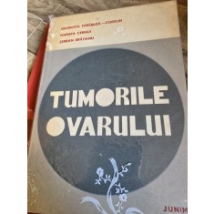 Tumorile ovarului - Georgeta Tarabuta-Cordun, Marieta Cernea, Serban Bratianu