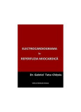 Electrocardiograma &icirc;n reperfuzia miocardică - Paperback brosat - Gabriel Tatu-Chiţoiu - Editura Medicală Antaeus