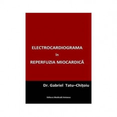 Electrocardiograma în reperfuzia miocardică - Paperback brosat - Gabriel Tatu-Chiţoiu - Editura Medicală Antaeus