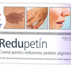 Crema pentru reducerea petelor pigmentare Redupetin, 20ml, Zdrovit