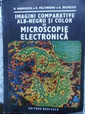 IMAGINI COMPARATIVE ALB-NEGRU SI COLOR DE MICROSCOPIE ELECTRONICA-N. MANOLESCU, D. PALTINEANU, R. BEGNESCU foto