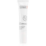 Cumpara ieftin Ziaja Med Brightening Care gel pentru ochi impotriva cearcanelor 15 ml