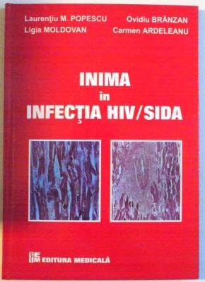 INIMA IN INFECTIA HIV/SIDA de LAURENTIU M. POPESCU, CARMEN ARDELEANU, 2007 foto