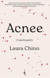 Acnee. O autobiografie - Laura Chinn