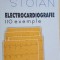 Electrocardiografie 110 exemple- Eduard Apetrei, Ioana Stoian