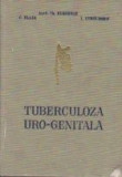 Tuberculoza uro - genitala