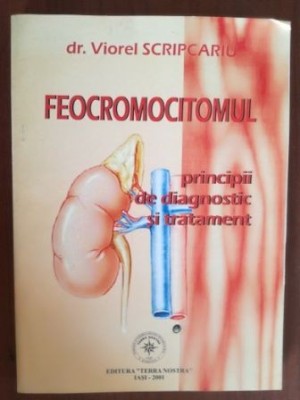 Feocromocitomul. Principii de diagnostic si tratament- Viorel Scripcariu foto