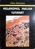 Melanomul Malign Cutanat - Doina Radulescu, 1996, Editura Gama, Carte de Medicina, Dermatologie, 133 Pagini