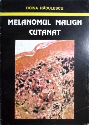 MELANOMUL MALIGN CUTANAT-DOINA RADULESCU-263856 foto