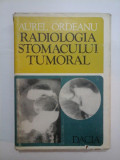 RADIOLOGIA STOMACULUI TUMORAL - AUREL ORDEANU