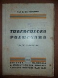 Tuberuloza pulmonara Tratat elementar - Gh. Tudoranu