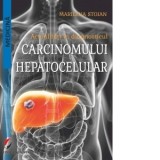 Actualitati in diagnosticul carcinomului hepatocelular - Marilena Stoian
