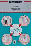 Cumpara ieftin Tuberculoza, John Crofton, 1992, 192 pg, brosata, engleza. Carte medicina interna