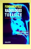 Fundamentele radiologiei toracice - D. Karthikeyan, Deepa Chegu