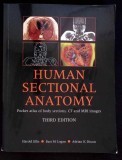 HUMAN SECTIONAL ANATOMY. POCKET ATLAS OF BODY SECTIONS, CT AND MRI IMAGES-HAROLD ELLIS, BARI M. LOGAN, ADRI-274973
