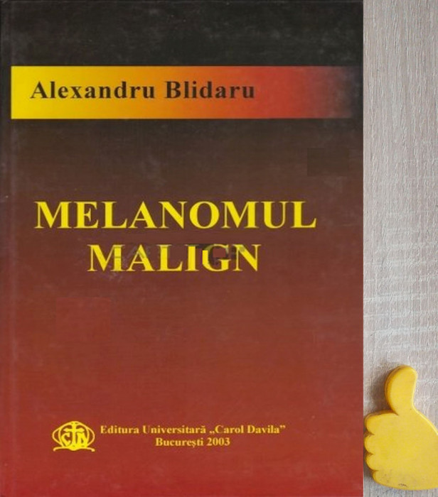 Melanomul malign Alexandru Blidaru