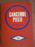 Cancerul pielii- Alex. Dimitrescu