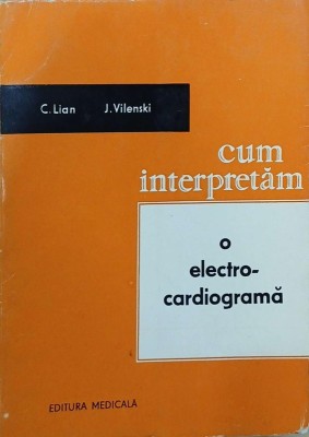 Cum interpretam o electrocardiograma - C. Lian, J. Vilenski foto