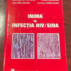 Inima în infecţia HIV/SIDA - Studii experimentale