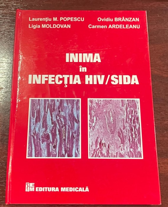 Inima &icirc;n infecţia HIV/SIDA - Studii experimentale