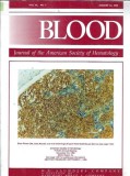 Cumpara ieftin Blood - Journal of the American Society of Hematology - 15 august 1998