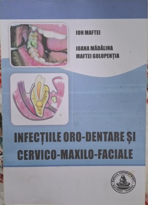 Infectii Oro-Dentare si Cervico-Maxilo-Faciale foto