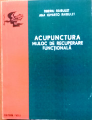 ACUPUNCTURA Mijloc recuperare functionala RAIBULET foto