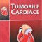 TUMORILE CARDIACE, M.E. PATRUT, GHE. MANOLE, G.V. DINCA