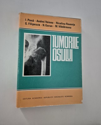 Medicina I Pana Tumorile osului foto