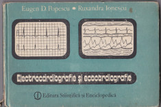 Electrocardiografie ?i ecocardiografie - Eugen D. Popescu, Ruxandra Ionescu foto