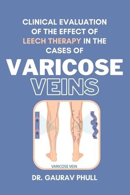 Clinical Evaluation of the Effect of Leech Therapy in the Cases of Varicose Veins foto