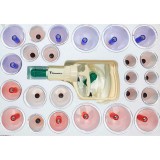 Cumpara ieftin Set 24 ventuze de masaj terapeutic cu vacuum, magnetoterapie si acupresura