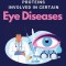Molecular Analysis of Proteins Involved in Certain Eye Diseases
